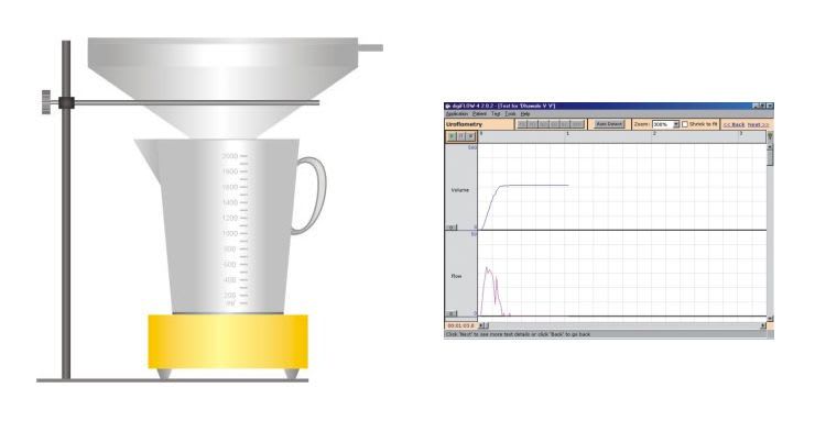 Computer-based urinary flow meter digiFLOW-4 CellSonic Medical