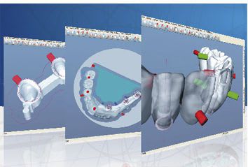 CAM software / for dental prosthesis design / CAD / medical SUM3D Dental CIMsystem s.r.l.