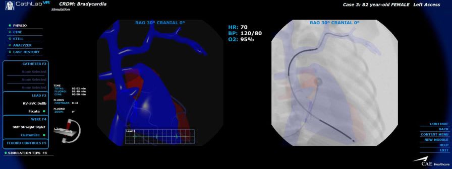Cardiovascular catheterization simulator CathLabVR CAE Healthcare