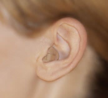 Full shell (ITE) hearing aid ITED INIZIA 3 bernafon