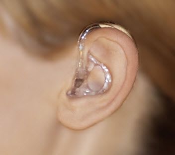 Mini behind the ear (mini BTE) hearing aid Compact Power Plus BTE INIZIA 1 bernafon