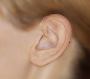 Behind the ear, hearing aid with ear tube Nano BTE INIZIA 3 bernafon