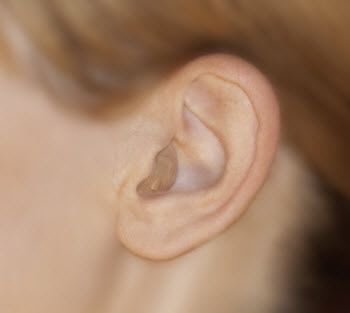 The canal (ITC) hearing aid ITCPD CHRONOS 5 bernafon
