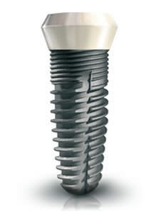 Cylindrical conical dental implant / titanium / one-stage / self-tapping Smilea Conic BIOTECH INTERNATIONAL