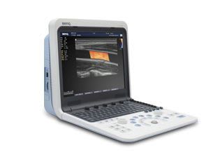 Portable ultrasound system / for multipurpose ultrasound imaging UP600 BENQ Medical Technology
