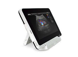 Portable doppler monitor / with touchscreen UP200 BENQ Medical Technology