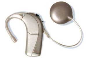 Behind the ear processor cochlear implant AURIA Advanced Bionics