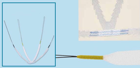 Urinary incontinence mesh reconstruction mesh / transobturator approach / for man SURGIMESH®M-SLING ASPIDE MEDICAL