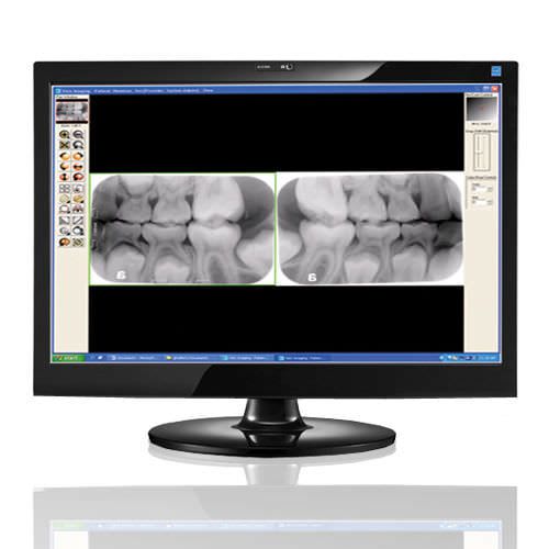 Dental imaging software / medical Visix® Air Techniques