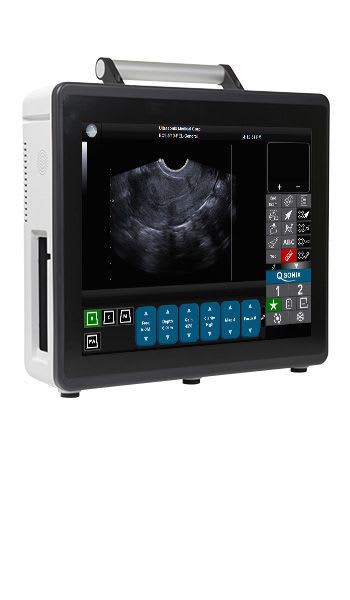 Portable ultrasound system / for multipurpose ultrasound imaging / touchscreen SONIXTABLET Analogic