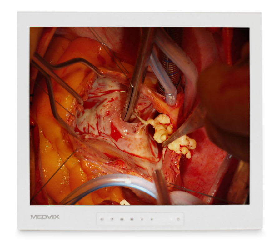 LCD display / surgical 19" | Medvix AMVX 1908 Ampronix