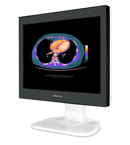 LCD display / medical 21.3", 2 MP | Modalixx GC212HB Ampronix