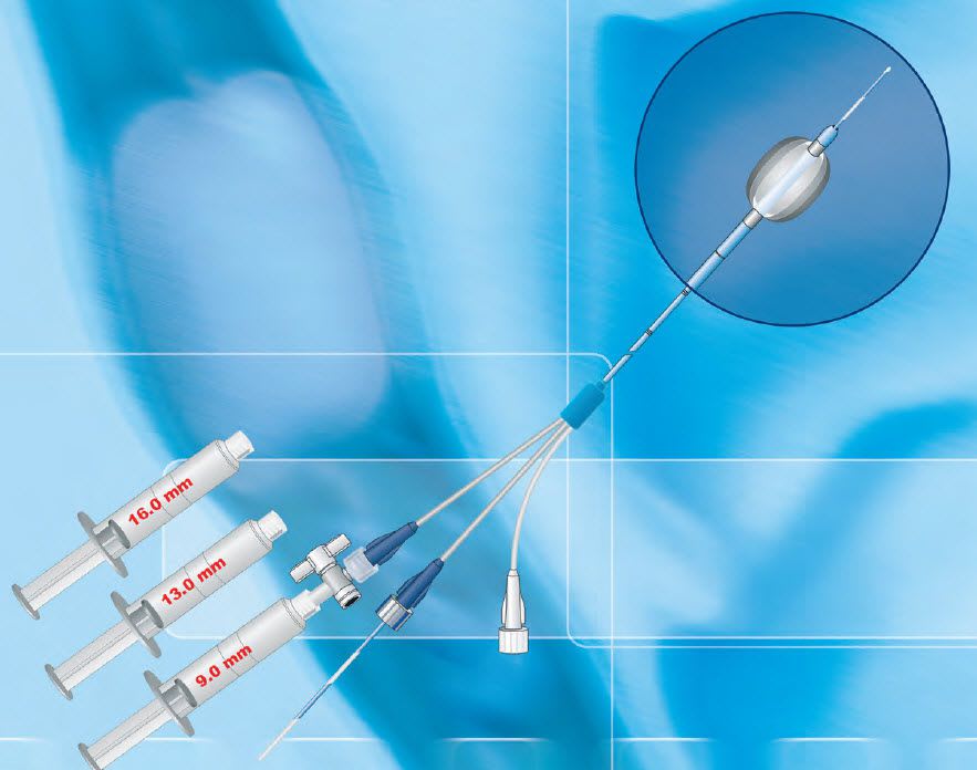 Extractor catheter / biliary / balloon / triple-lumen GEB-xx series Asept Inmed