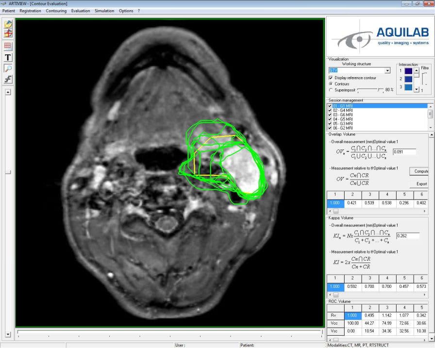 Contour detection software / for radiation therapy ARTISTRUCT™ AQUILAB