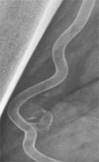 Peripheral stent Supera Abbott Vascular