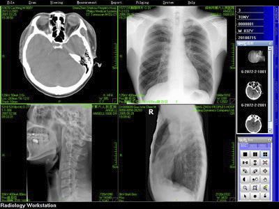 Diagnostic software / viewing / sharing / radiology Angell technology