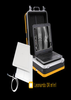 The portable Leonardo DR mini system for mobile radiography, tethered or wireless